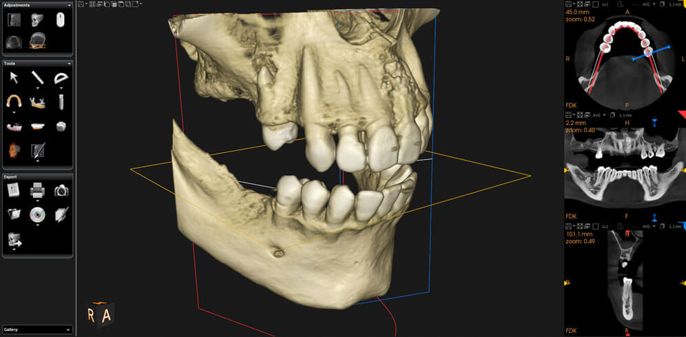 MVZ MediDent 147 GmbH/Endo 147, Berlin - Bildschirm stellt ein Röntgenbild eines Kiefers dar. Das Bildschrim befindet sich in einer Zahnarztpraxis. Zwei Hände mit blauen Latexschuhe zeigt auf das Bild.